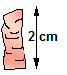 Ileum